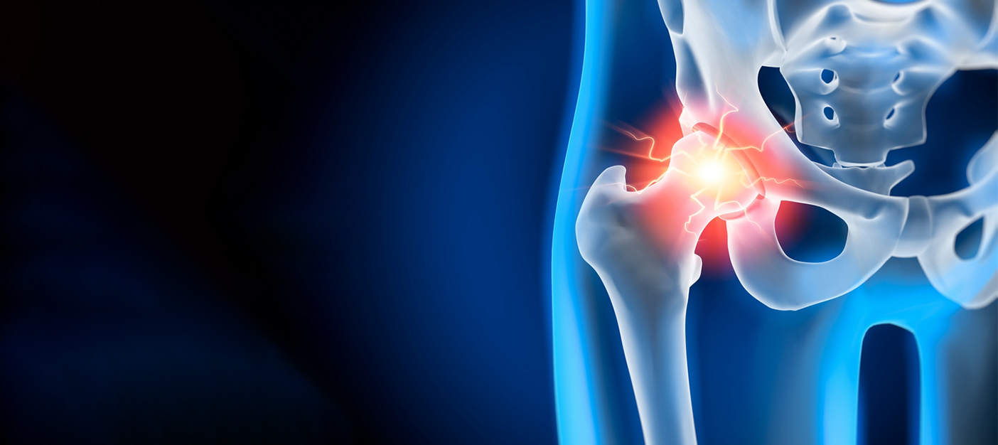 Total Hip Replacement: What To Expect Before, During & After Surgery